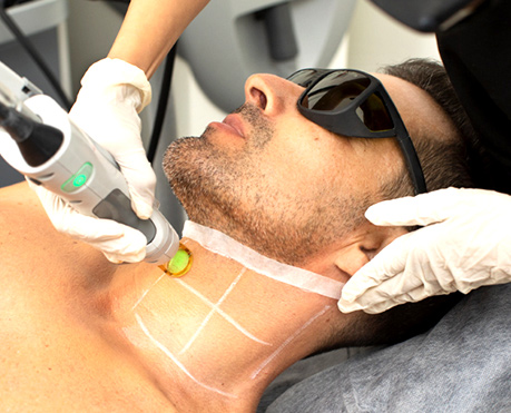 Laser Hair Reduction